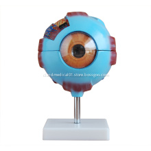 Giant Eye Model for Medical Teaching